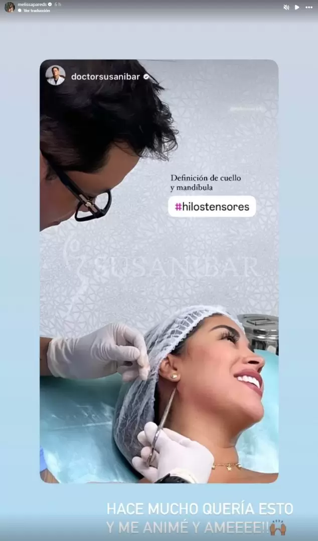 Melissa Paredes se somete a nuevo retoquito