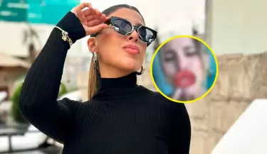 Yahaira se divierte con filtro de labios tras retoquito