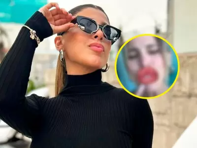 Yahaira se divierte con filtro de labios tras retoquito