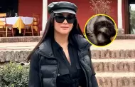 Rosngela Espinoza rescata a perrito de la calle pero da mala noticia: "Con el dolor de mi corazn"