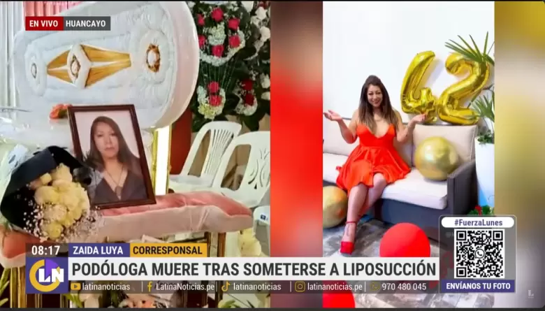 Mujer muere tras someterse a liposuccin